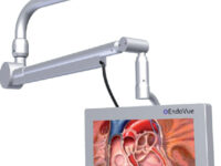 BRACCIO PORTA MONITOR - indipendente